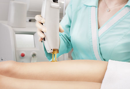 Laser Hair Removal Glossary - Body Beautiful Laser Medi-spa