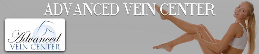 best pricing near me, vein care, Advanced Vein Center Banner, , Services and Pricing