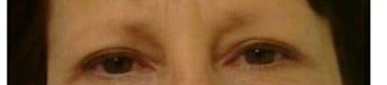 Before permanent makeup eyebrows