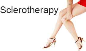 Sclerotherapy, VIP Membership Sign Up, Contact us, interested procedures,