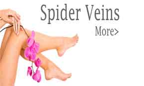 Spider Veins, VIP Membership Sign Up, Contact us, interested procedures,