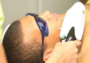 photofacials male Treatment Process Traditional IPL