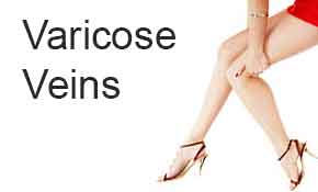 Varicose Veins, VIP Membership Sign Up, Contact us, interested procedures,