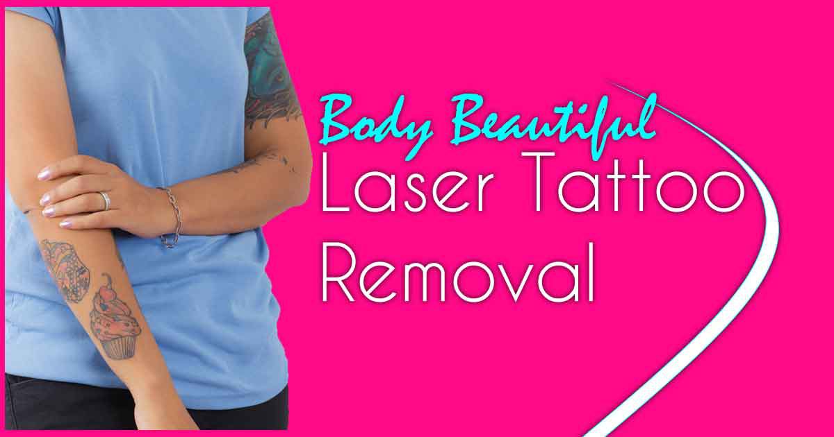Laser Tattoo Removal