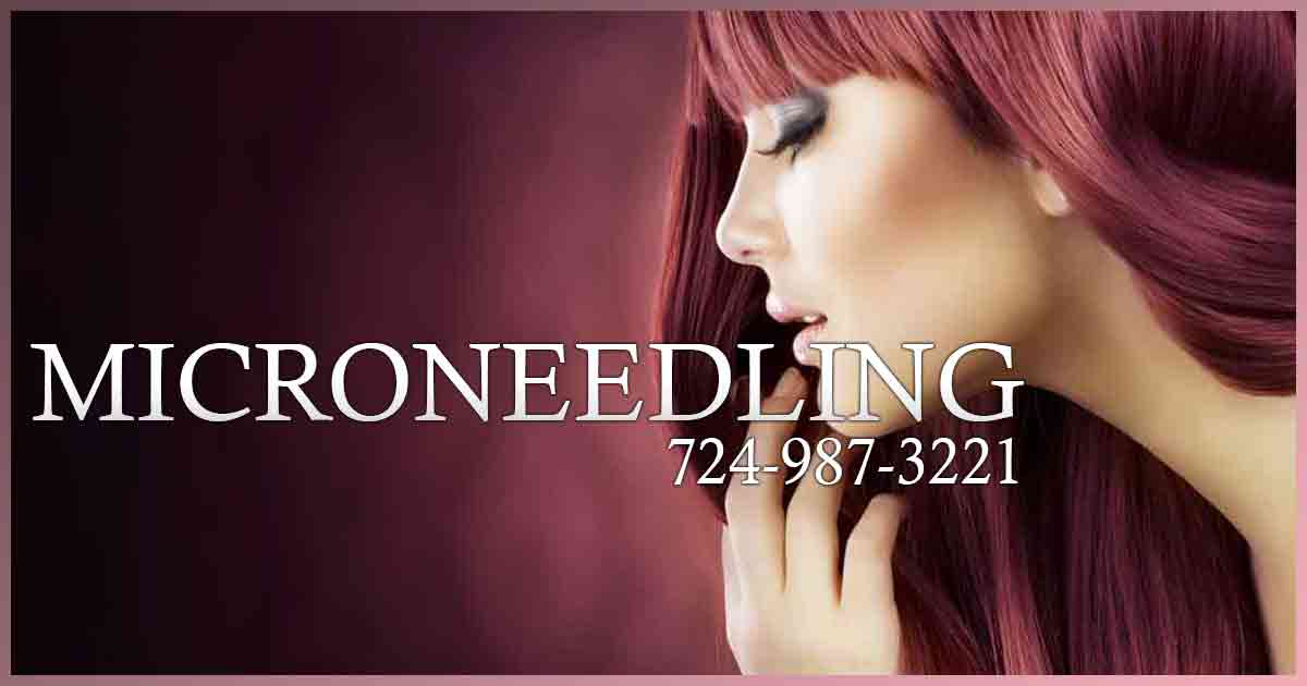 Microneedling — Body Beautiful