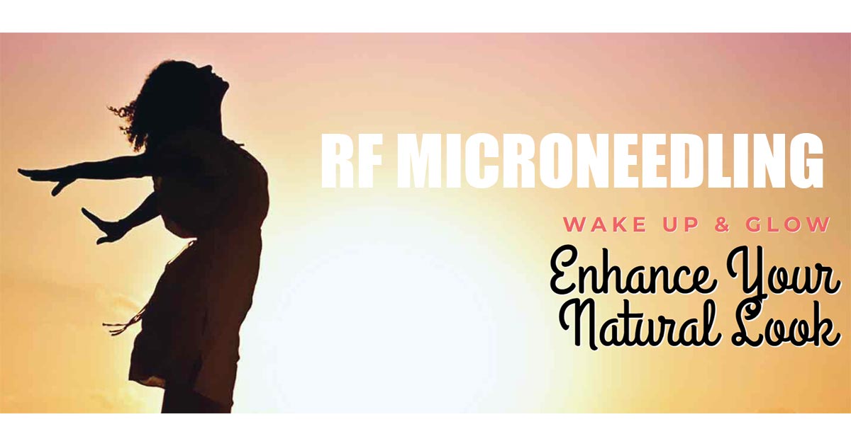 RF Microneedling — Body Beautiful